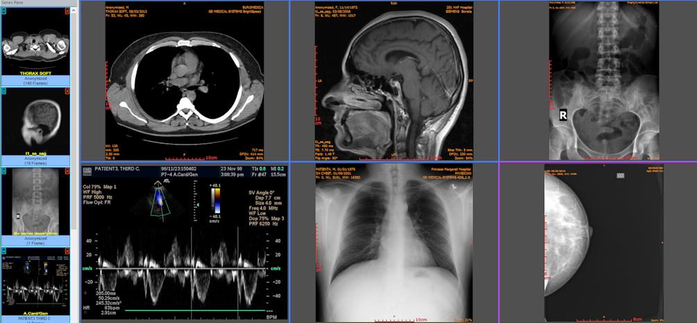 Radiology Integration and PACS